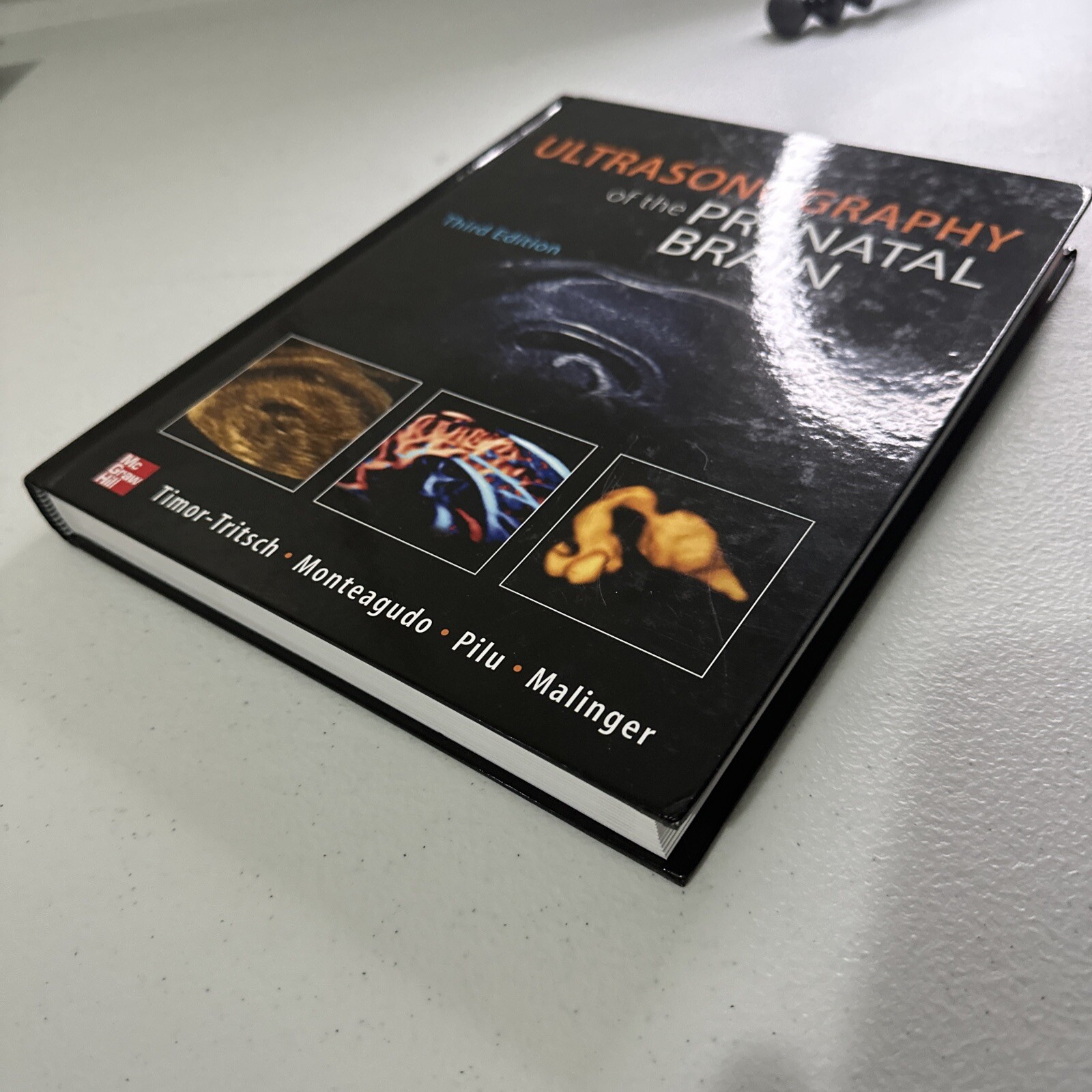 Ultrasonography of the Prenatal Brain, Third Edition by Ana Monteagudo, Ilan…