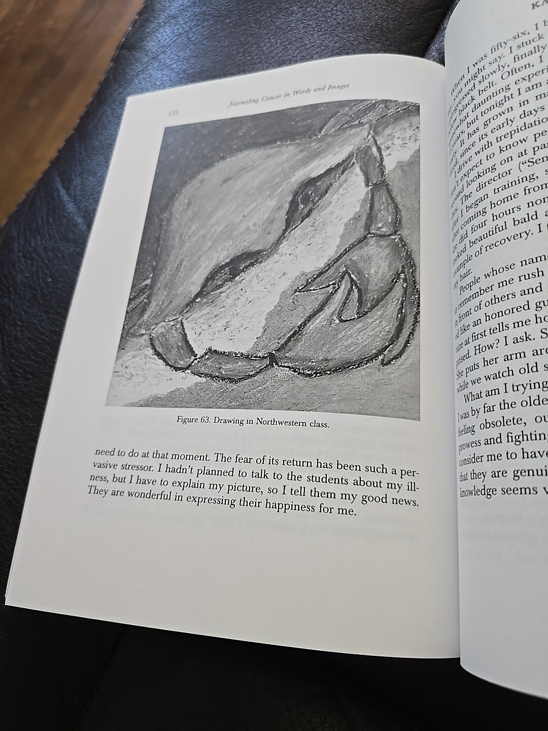 Journaling Cancer in Words and Images : Caught in the Clutch of the Crab SIGNED