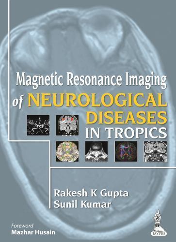 Magnetic Resonance Imaging of Neurological Diseases in Tropics by Sunil Kumar…