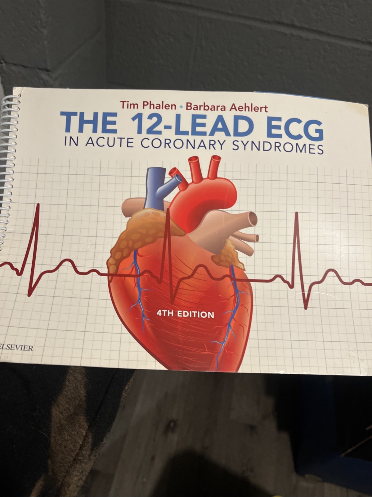 12-Lead ECG in Acute Coronary Syndromes by Tim Phalen and Barbara J. Aehlert